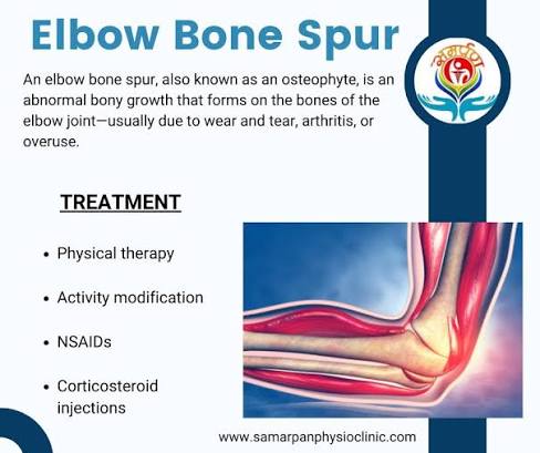 elbow bone spur